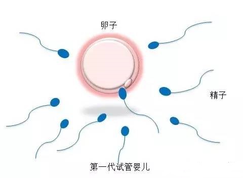 专家